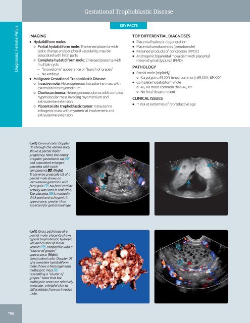 Diagnostic Ultrasound - Abdomen and Pelvis