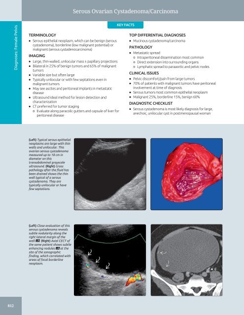 Diagnostic Ultrasound - Abdomen and Pelvis