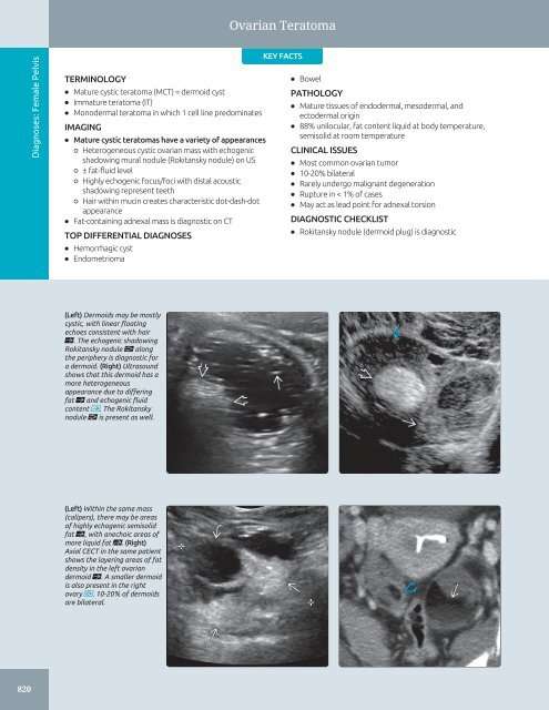 Diagnostic Ultrasound - Abdomen and Pelvis