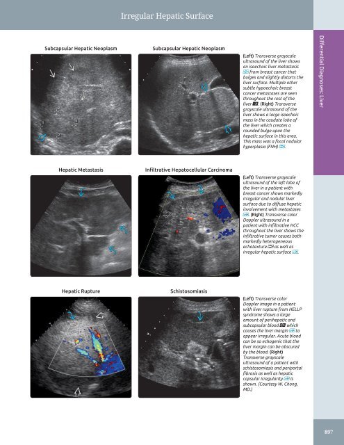 Diagnostic Ultrasound - Abdomen and Pelvis