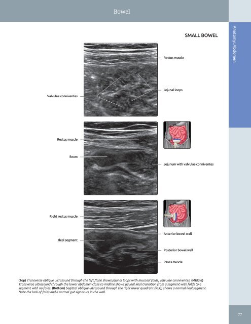 Diagnostic Ultrasound - Abdomen and Pelvis