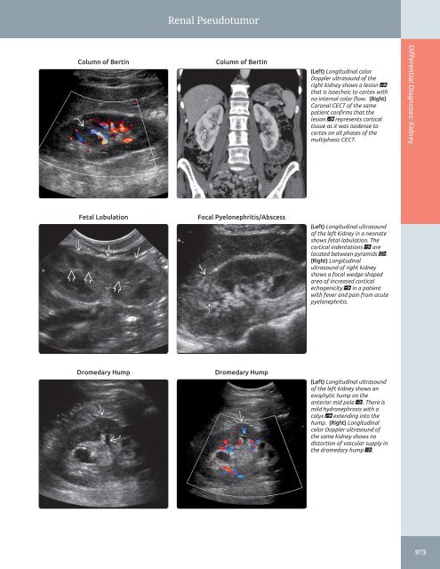 Diagnostic Ultrasound - Abdomen and Pelvis