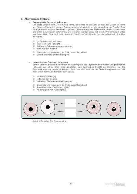 Die „andere“ Art Contactlinsen zu tragen - TECHNO-LENS ...