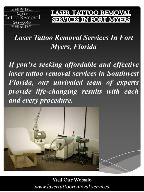 Laser Tattoo Removal Services In Fort Myers