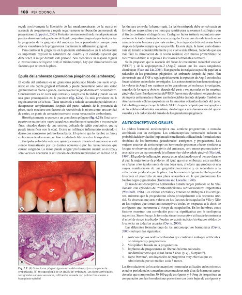 Periodoncia.Eley.6a.Ed