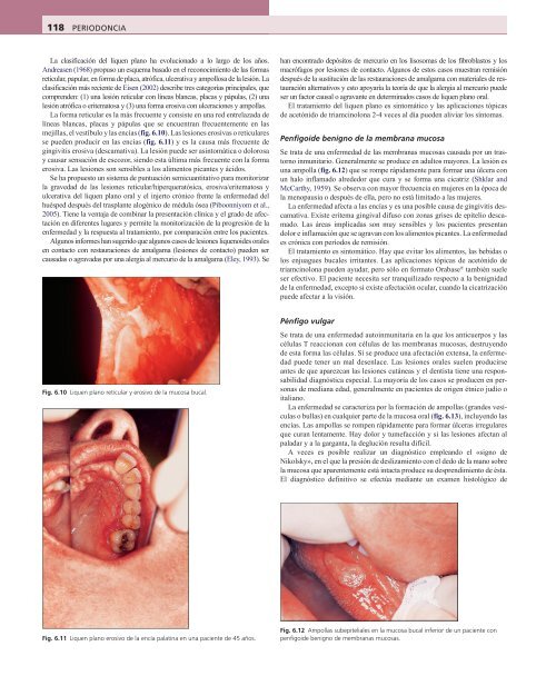 Periodoncia.Eley.6a.Ed