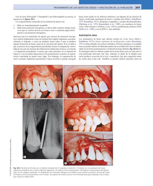 Periodoncia.Eley.6a.Ed