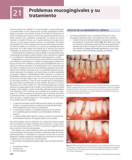 Periodoncia.Eley.6a.Ed