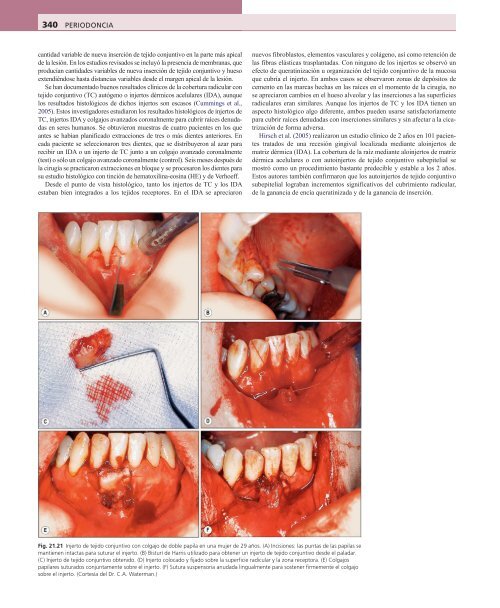 Periodoncia.Eley.6a.Ed