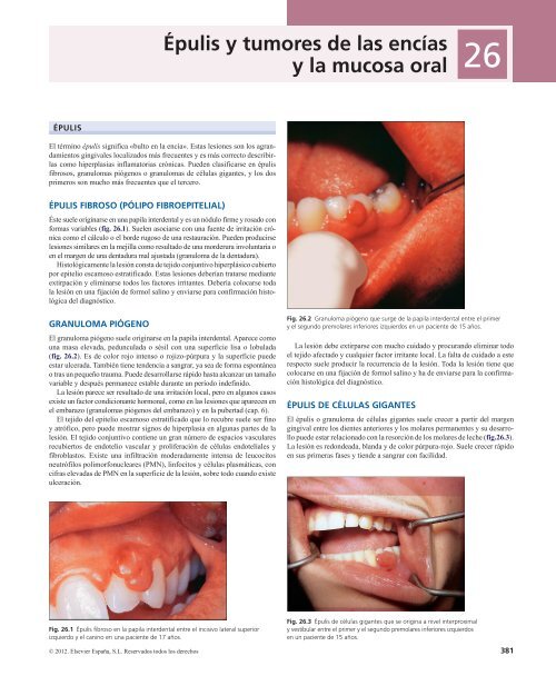 Periodoncia.Eley.6a.Ed