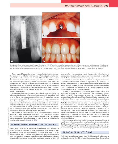 Periodoncia.Eley.6a.Ed