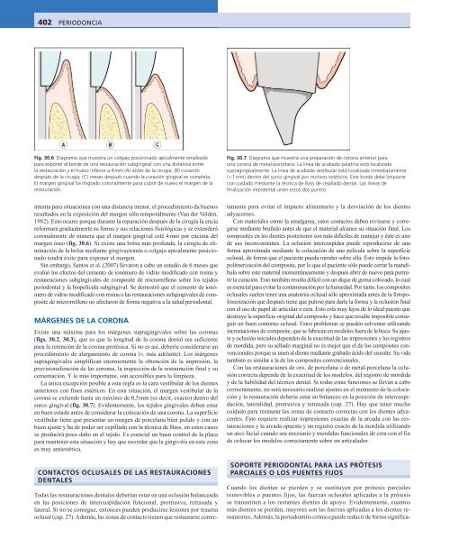 Periodoncia.Eley.6a.Ed