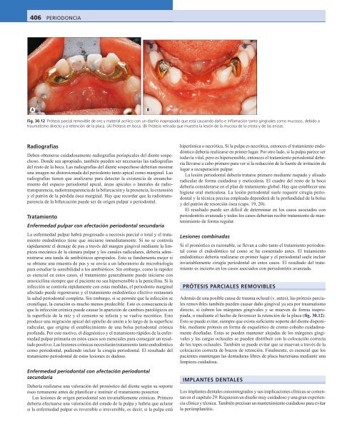 Periodoncia.Eley.6a.Ed