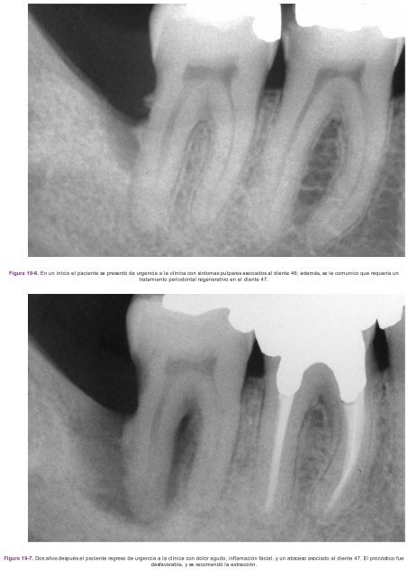 Periodoncia.e.Implantologia.Dental.de.Hall