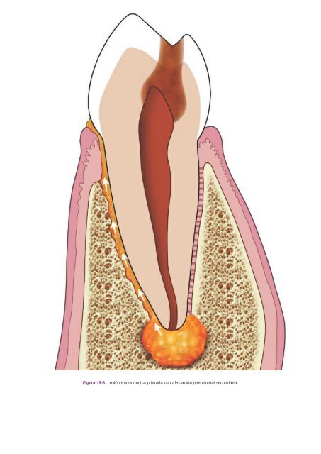 Periodoncia.e.Implantologia.Dental.de.Hall