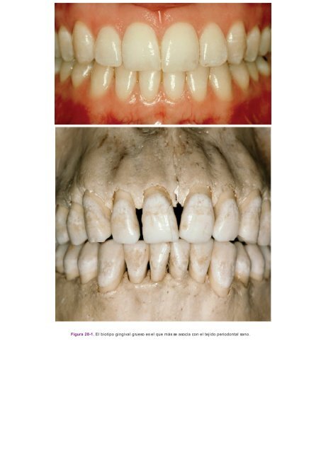 Periodoncia.e.Implantologia.Dental.de.Hall