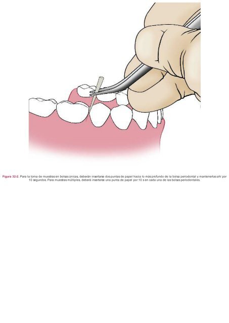 Periodoncia.e.Implantologia.Dental.de.Hall