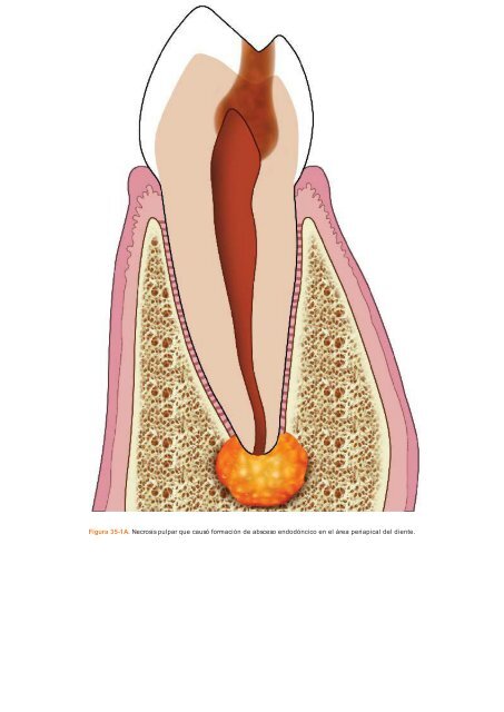 Periodoncia.e.Implantologia.Dental.de.Hall