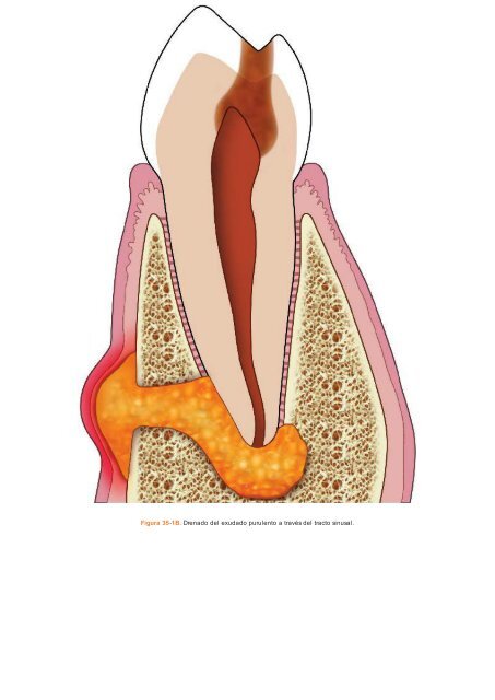 Periodoncia.e.Implantologia.Dental.de.Hall