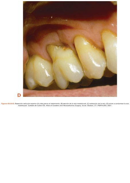 Periodoncia.e.Implantologia.Dental.de.Hall