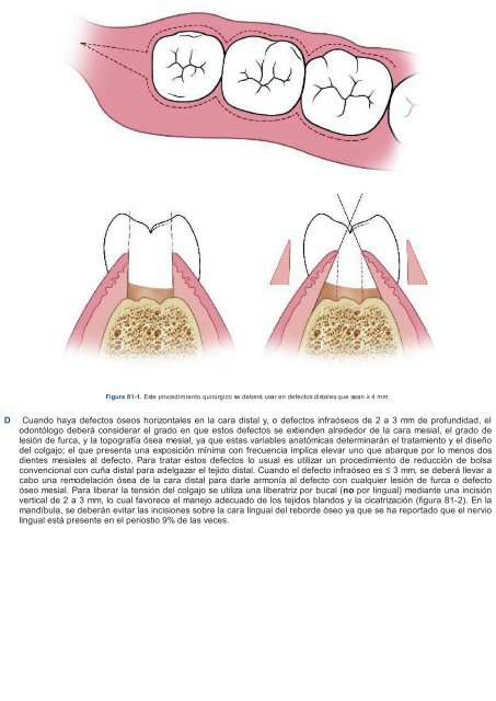 Periodoncia.e.Implantologia.Dental.de.Hall