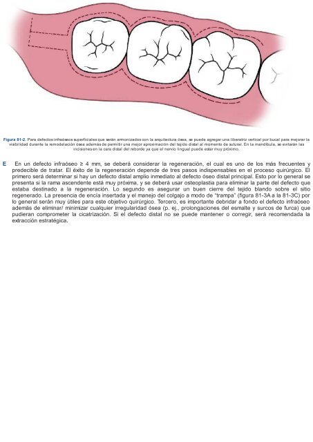 Periodoncia.e.Implantologia.Dental.de.Hall