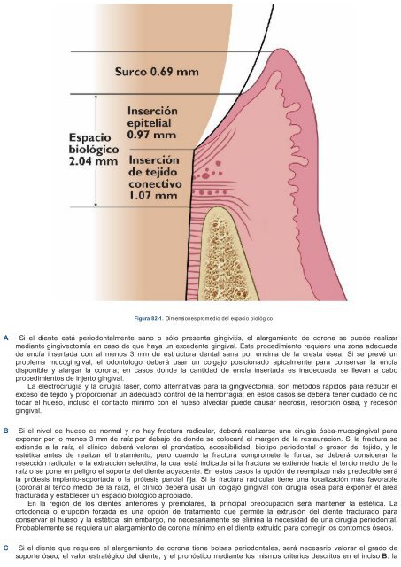 Periodoncia.e.Implantologia.Dental.de.Hall