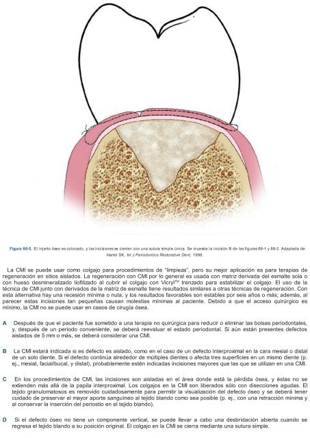 Periodoncia.e.Implantologia.Dental.de.Hall