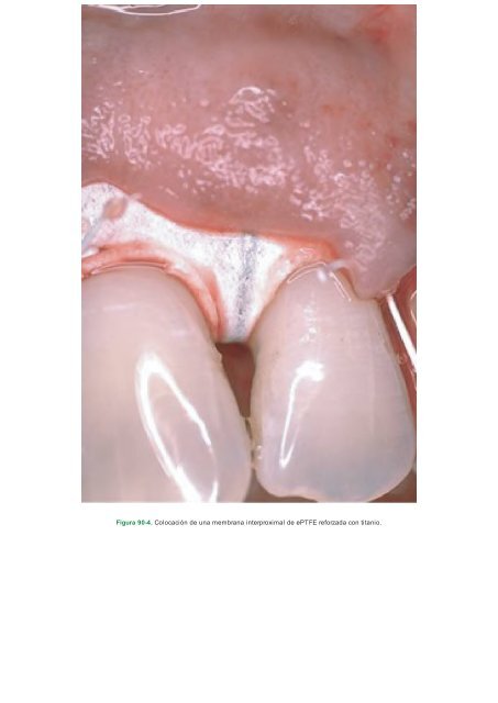 Periodoncia.e.Implantologia.Dental.de.Hall