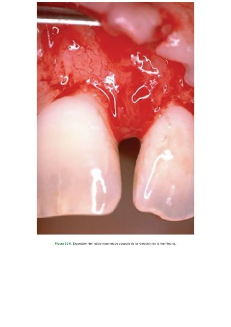 Periodoncia.e.Implantologia.Dental.de.Hall