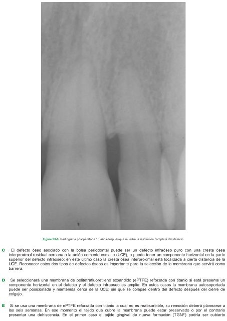 Periodoncia.e.Implantologia.Dental.de.Hall