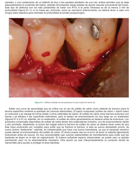 Periodoncia.e.Implantologia.Dental.de.Hall