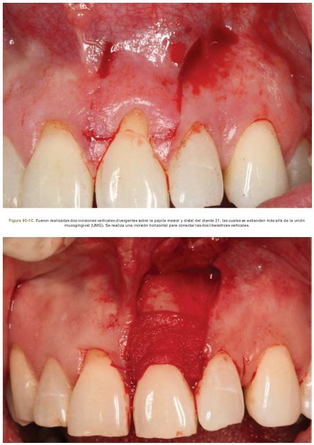 Periodoncia.e.Implantologia.Dental.de.Hall