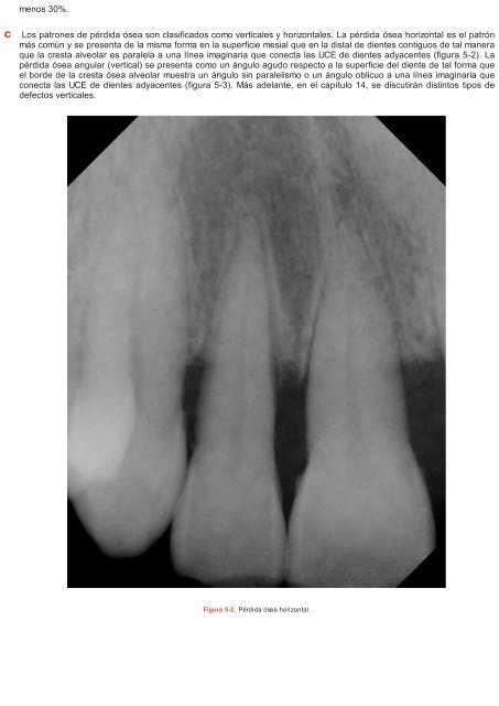 Periodoncia.e.Implantologia.Dental.de.Hall