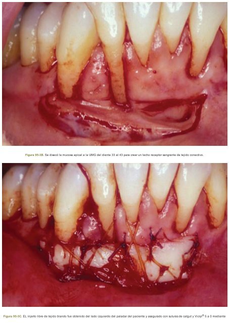 Periodoncia.e.Implantologia.Dental.de.Hall