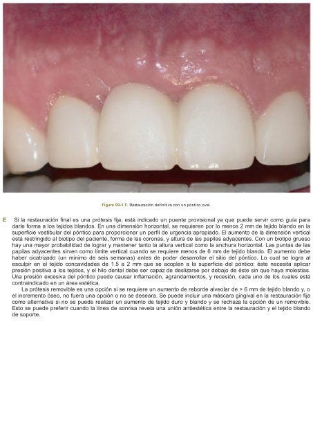 Periodoncia.e.Implantologia.Dental.de.Hall