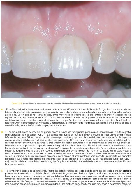 Periodoncia.e.Implantologia.Dental.de.Hall