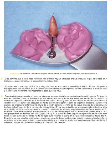 Periodoncia.e.Implantologia.Dental.de.Hall