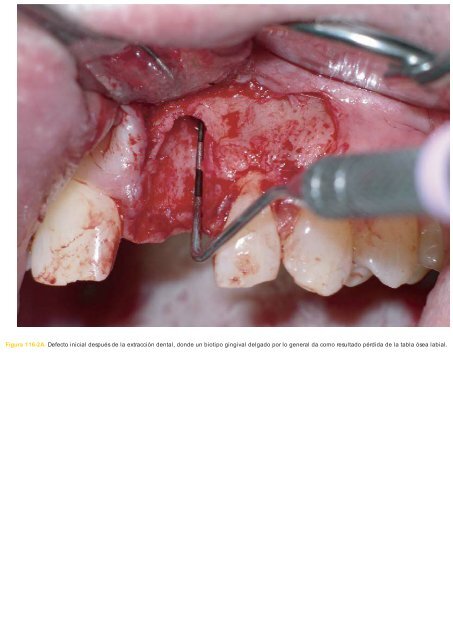 Periodoncia.e.Implantologia.Dental.de.Hall