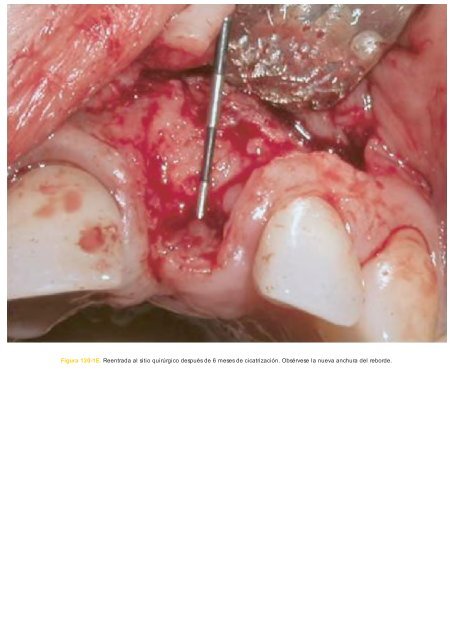 Periodoncia.e.Implantologia.Dental.de.Hall