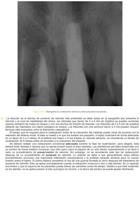 Periodoncia.e.Implantologia.Dental.de.Hall