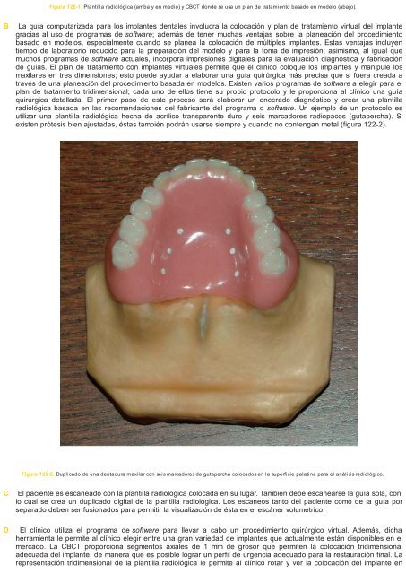 Periodoncia.e.Implantologia.Dental.de.Hall