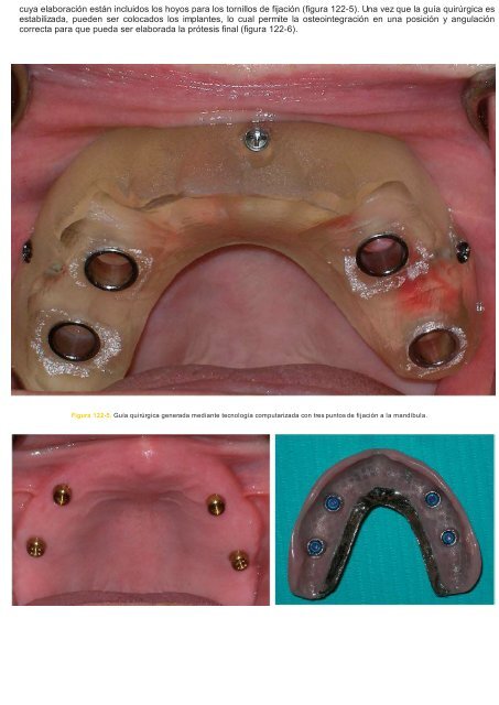 Periodoncia.e.Implantologia.Dental.de.Hall