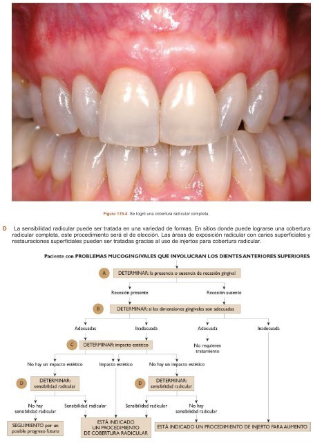 Periodoncia.e.Implantologia.Dental.de.Hall