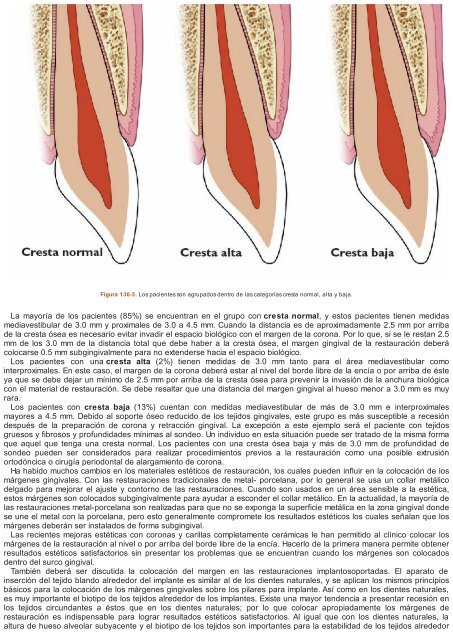 Periodoncia.e.Implantologia.Dental.de.Hall