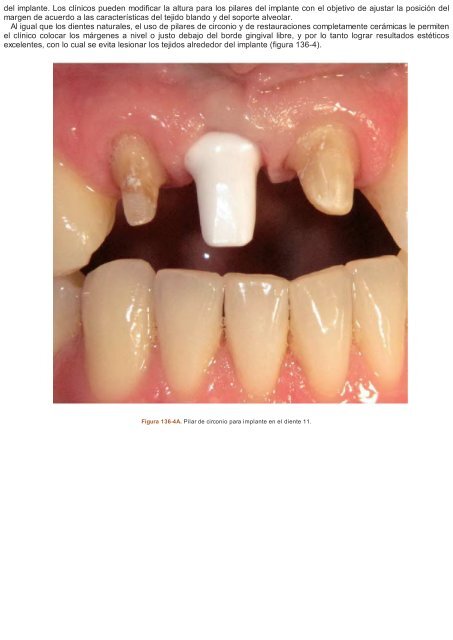 Periodoncia.e.Implantologia.Dental.de.Hall