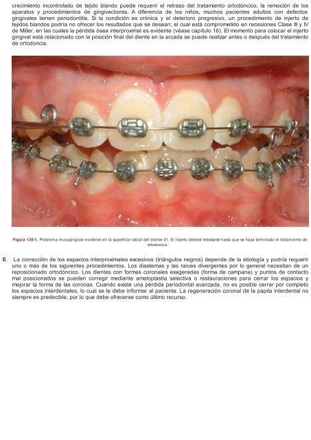 Periodoncia.e.Implantologia.Dental.de.Hall