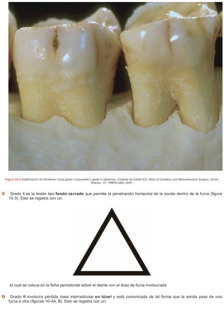 Periodoncia.e.Implantologia.Dental.de.Hall