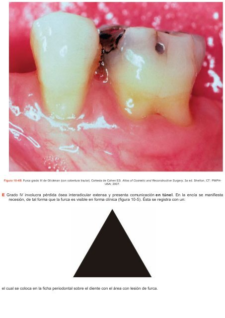 Periodoncia.e.Implantologia.Dental.de.Hall