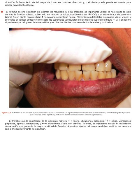 Periodoncia.e.Implantologia.Dental.de.Hall